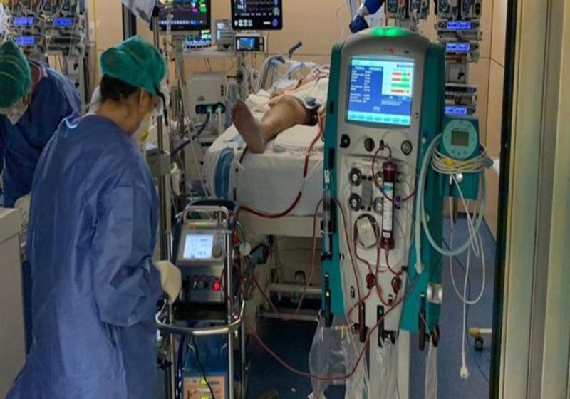  Usan oxigenación extracorpórea para mantener vivos a pacientes COVID-19