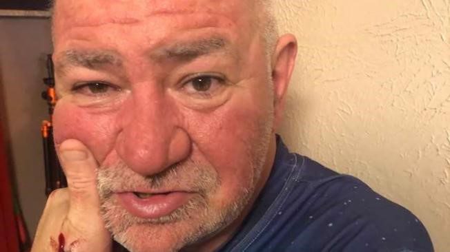  Falso médico asesinaba a sus pacientes y se alimentaba con su carne Falo su plato preferido