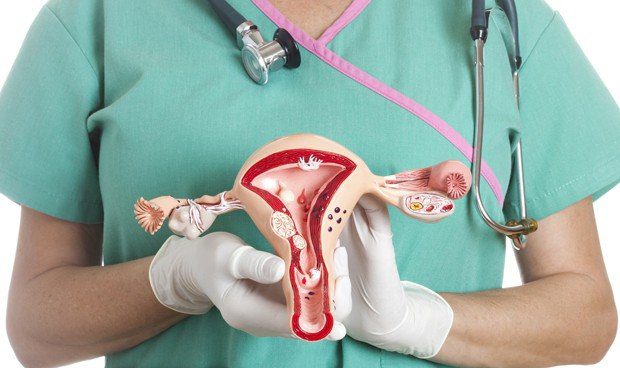  La tasa de cáncer de cuello de útero se reduce en un 87 % en vacunadas de VPH